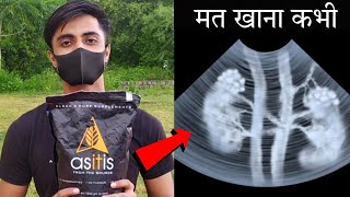 ASITIS Side Effects  हो गया खुलासा इस सस्ते ब्रांड का  Asitis Review protein gymlife [upl. by Halac]