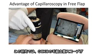 Capillaroscope Essentials 2 Microsurgery Research Dr Kento Yamamoto GOKO Webinar for IMC [upl. by Eiramait423]