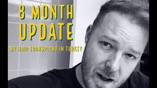 8 MONTH UPDATE My Hair Transplant in TURKEY [upl. by Saunder861]