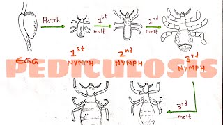 Pediculosis  Pediculus humanus  Structure Life cycle Transmission  Head lice and body lice [upl. by Devaj894]