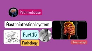 Gastrointestinal system part 15  pathology path usmlesteps [upl. by Ahsaf664]