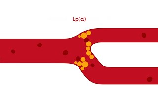 What is Lipoprotein a [upl. by Ellery]