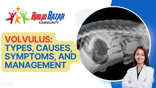 🌀 Understanding Volvulus Types Symptoms and Treatment Options 🏥 [upl. by Jenny]