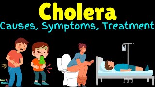 Cholera – Symptoms Causes Pathogenesis Diagnosis Treatment Complications Prevention amp Vaccine [upl. by Alahcim]