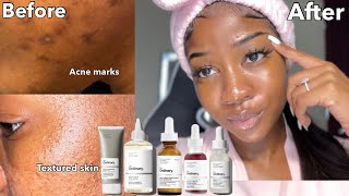 Face Oils Best Oil for Your Skin Concerns Hyperpigmentation Acne Aging Skin Oily Skin Dry Skin [upl. by Cristabel]