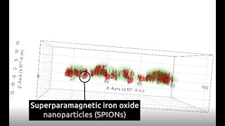 Superparamagnetic iron oxide nanoparticles SPIONs and Nanolive imaging the perfect combination [upl. by Ynabla]