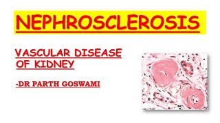 Nephrosclerosis [upl. by Duester736]