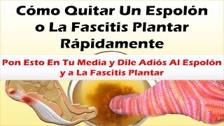 Pon Esto En Tu Media y Dile Adiós Al Espolon y a La Fascitis Plantar Como Quitar Un Espolon Rapido [upl. by Elliott]