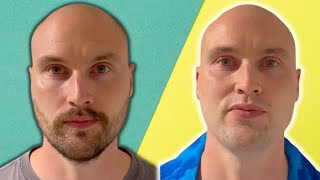 BEST Facial Hair Style For The BALD MAN [upl. by Nerraf]