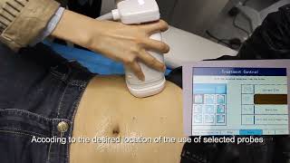 Liposonix hifu Machine body slimming procedure  liposonix hifu body sculpting Case in action [upl. by Aleafar]