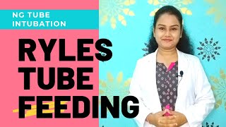 RYLES TUBE FEEDING PROCEDURE  NASOGASTRIC INTUBATION [upl. by Refitsirhc]