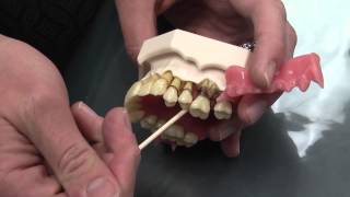 What is Periodontal Disease [upl. by Ddarb246]