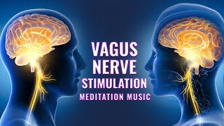 Vagus Nerve Stimulation Frequency  Rewire Your Brain From Anxiety  Vagal Tone to Heal Vagus Nerve [upl. by Amorete]