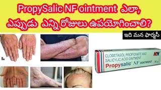 propysalic nf ointment  uses how to to apply sideeffects precautions [upl. by Clarance]