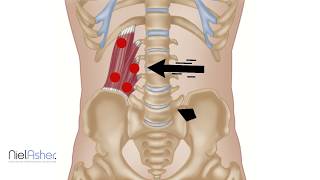 Quadratus Lumborum  Trigger Point Anatomy [upl. by Abih400]