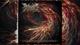 Sparganum Proliferum  Parasitic Mutated Infecting Of Human Beings Full Album [upl. by Ranchod]