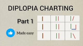 DIPLOPIA CHARTING PART 1  Basics of diplopia charting  Optometry [upl. by Nayar]