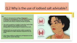 Why is the use of iodised salt advisable [upl. by Kucik]