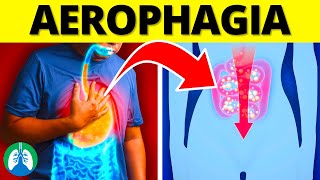 Aerophagia Medical Definition  Quick Explainer Video [upl. by Adon]