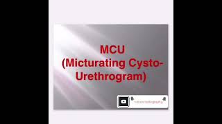 MCU micturation cystourethrogram [upl. by Estes]