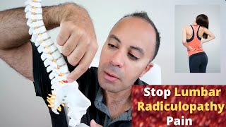 End Lumbar Radiculopathy Naturally Symptoms Causes Risk Factors Healing Cycle amp Treatment [upl. by Anayia785]