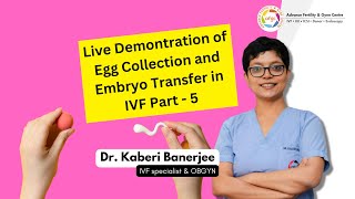 Live Demonstration of Egg Collection and Embryo Transfer in IVF By Dr Kaberi Banerjee  Part 5 [upl. by Viviyan]