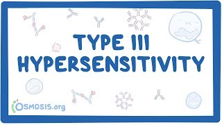 Type III hypersensitivity immune complex mediated  causes symptoms amp pathology [upl. by Tai]