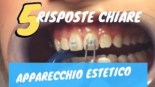 5 risposte CHIARE sullapparecchio ESTETICO [upl. by Gnak850]