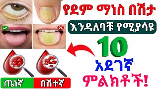 የደም ማነስ በሽታ 10 አደገኛ ምልክቶች   10 dangerous signs of anemia  Dr Nahom [upl. by Idac]