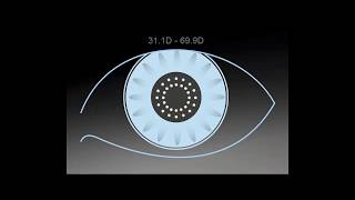 Tip Instructional – Eyesuite Biometry Keratometry [upl. by Thorwald677]