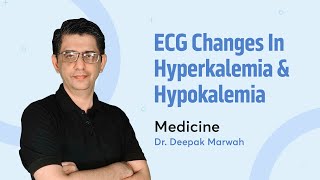 ECG changes in Hyperkalemia and Hypokalemia  Dr Deepak Marwah  Medicine  PrepLadder [upl. by Waterman]