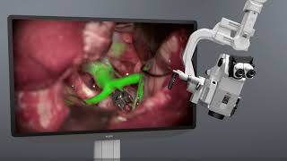 Surgical visualization solutions with Leica Microsystems [upl. by Dyane]