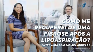 Clínica Unyca  Como Me Recuperei de Uma Fibrose Após a Lipoaspiração [upl. by Osnofedli]