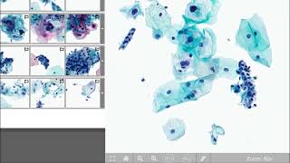 Digital Cytology Education Website [upl. by Yahc950]