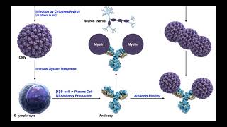 GuillainBarré Syndrome  Mechanism amp Presentation [upl. by Kipp55]