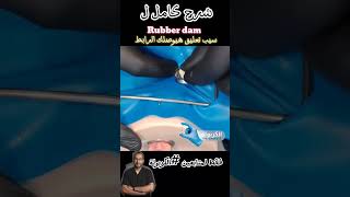 Rubber dam application demo الكربولة endodontics [upl. by Kreiner]