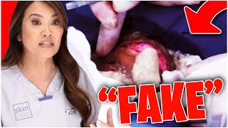 This is why Dr Pimple Popper is ACCUSED OF BEING FAKE [upl. by Alleyne]