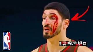 WORST amp BLOODY NBA Injuries 2021 NBA [upl. by Yentuoc]