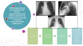 ASPERGILLOSIS BRONCOPULMONAR ALÉRGICA [upl. by Ailelc706]