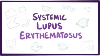 Systemic lupus erythematosus SLE  causes symptoms diagnosis amp pathology [upl. by Skvorak]