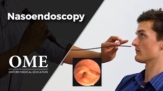 Nasoendoscopy Nose Examination  ENT [upl. by Darom549]