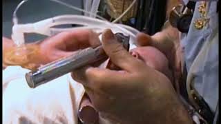 737 Intubation of an Infant [upl. by Emelin]