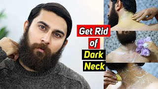 Get Rid of Dark Neck in 3 Days  NECK WHITENING AT HOME  Home Remedies [upl. by Boylan]