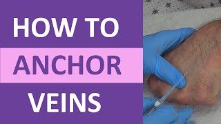 How to Anchor Veins  Venipuncture IV Therapy Blood Draw Phlebotomy Rolling Veins [upl. by Einitsed272]