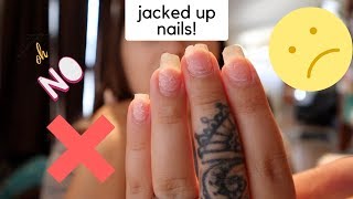 HOW TO fix nails AFTER acrylics [upl. by Pedrotti504]