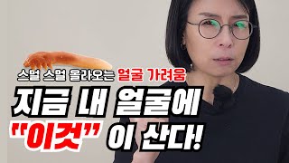 얼굴은 깨끗한데 스멀 스멀 올라오는 얼굴가려움 내 얼굴에 무언가 살고있다🤔 [upl. by Anaile]