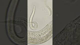 Phylum Aschelminthes Nematoda Roundworms [upl. by Ocsecnarf720]