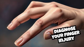 Discover the Diagnosis Jammed or Broken Finger [upl. by Rinna98]