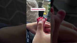 Babinski Reflex psychology [upl. by Acinorehs]