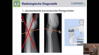 1011  Behandlungsalgorithmus der distalen Radiusfraktur [upl. by Phio509]